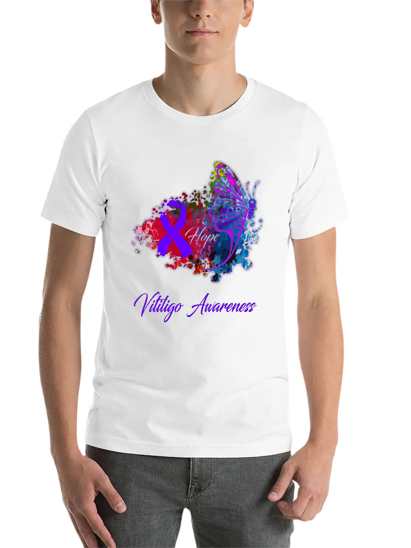 Vitiligo Awareness Comfortable Minimalist Graphic Tee – Summer Style Essential
