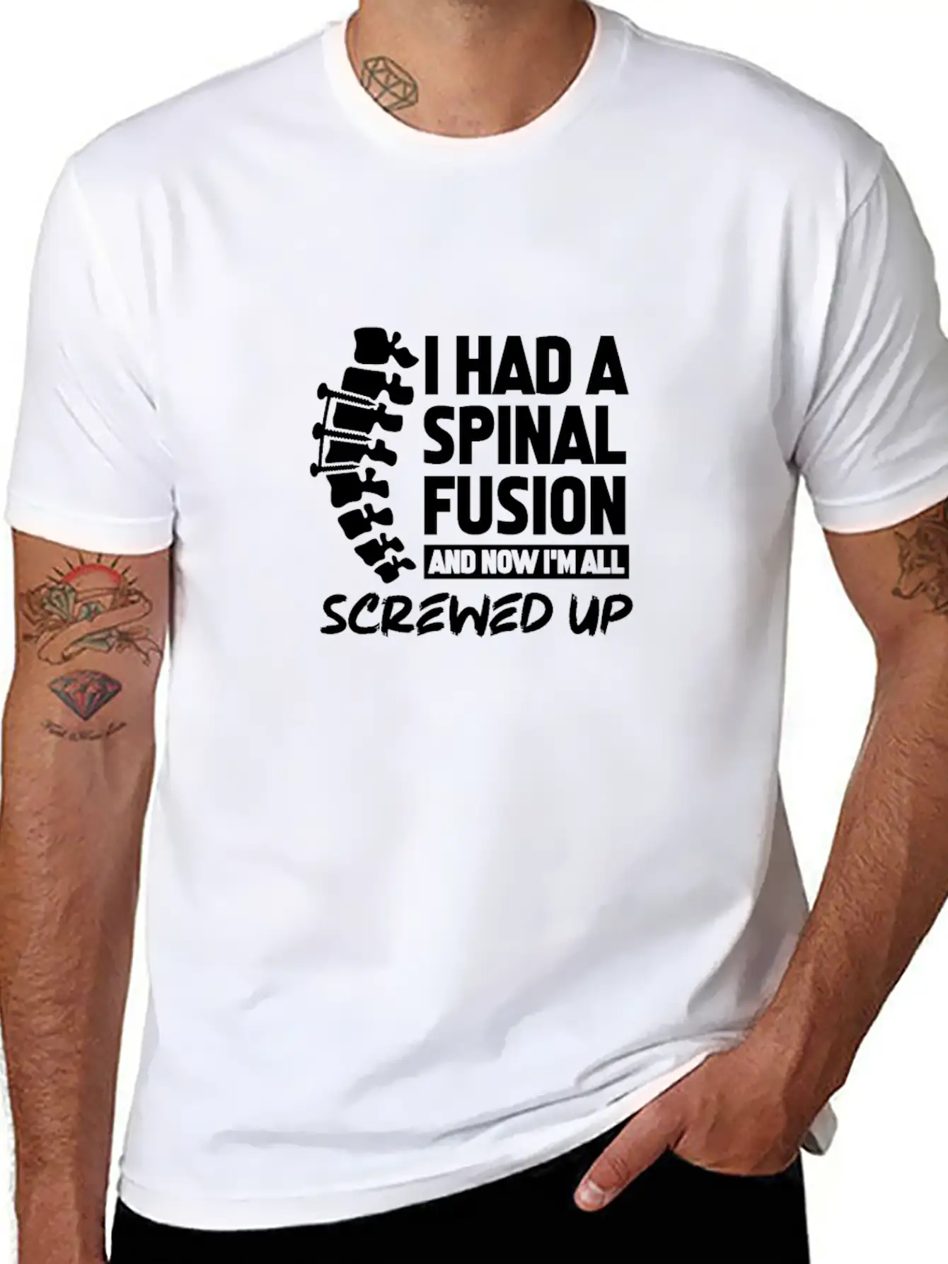 I Had A Spinal Fusion And Now I'm All Screwed Up Basic Graphic T-Shirt – Daily Comfort In Soft Cotton