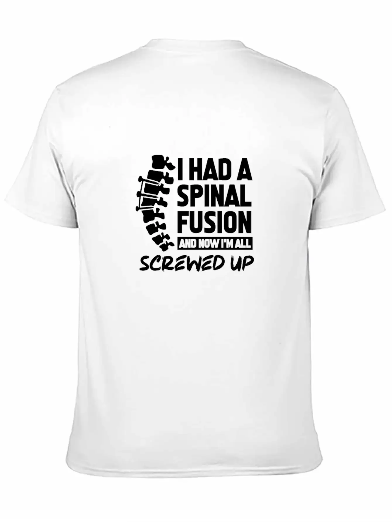 I Had A Spinal Fusion And Now I'm All Screwed Up Basic Graphic T-Shirt – Daily Comfort In Soft Cotton