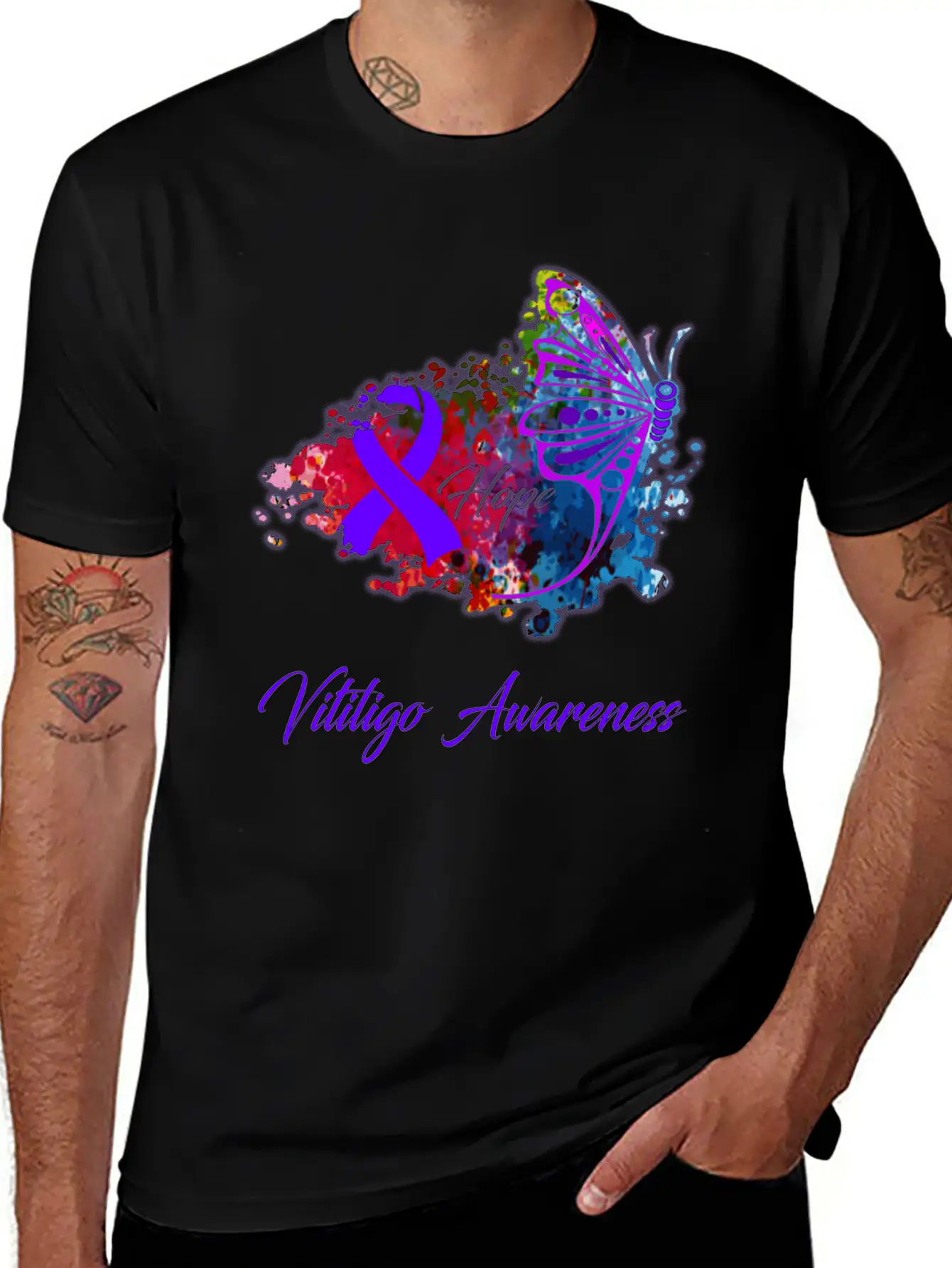 Vitiligo Awareness Comfortable Minimalist Graphic Tee – Summer Style Essential