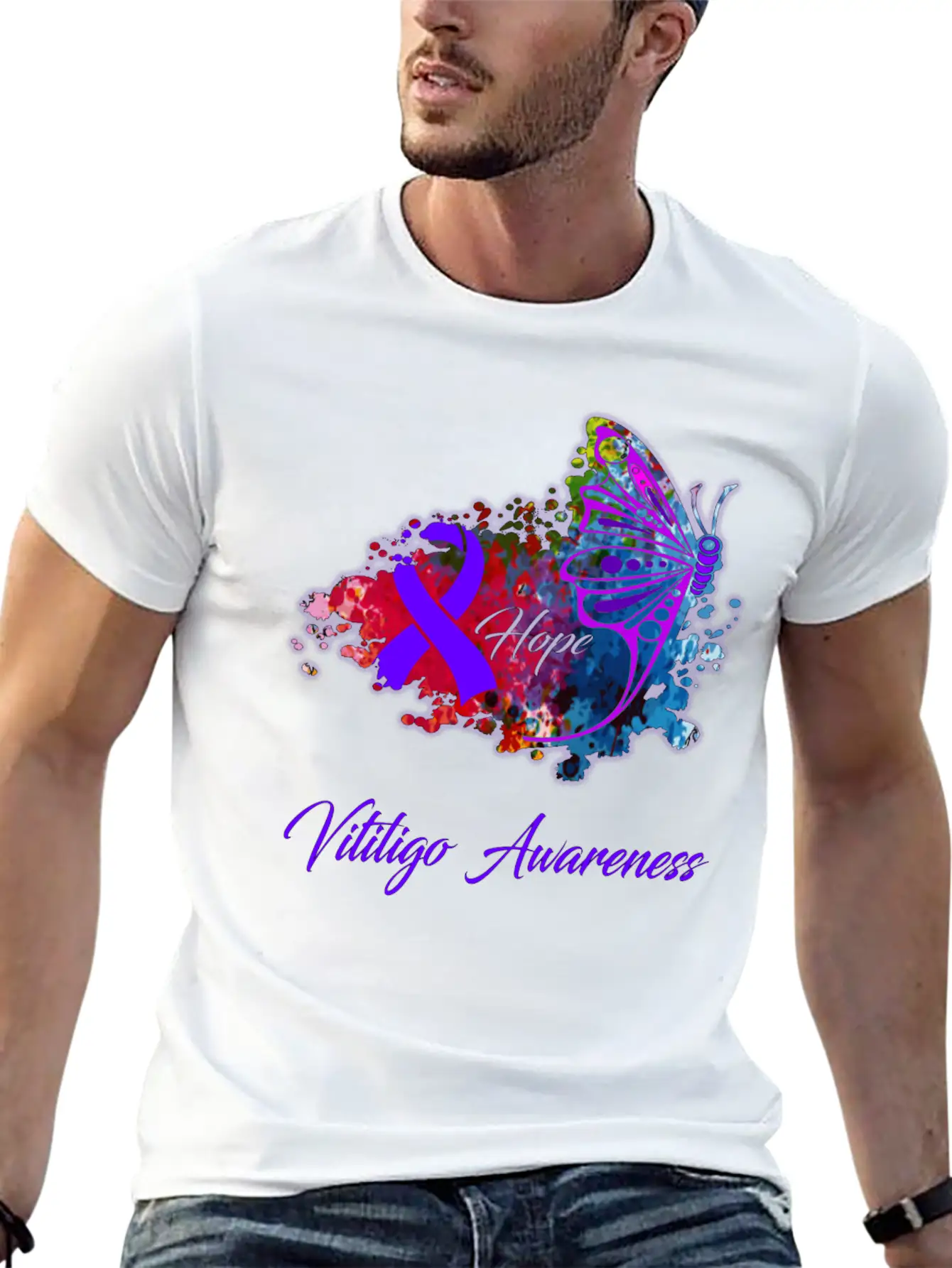Vitiligo Awareness Comfortable Minimalist Graphic Tee – Summer Style Essential