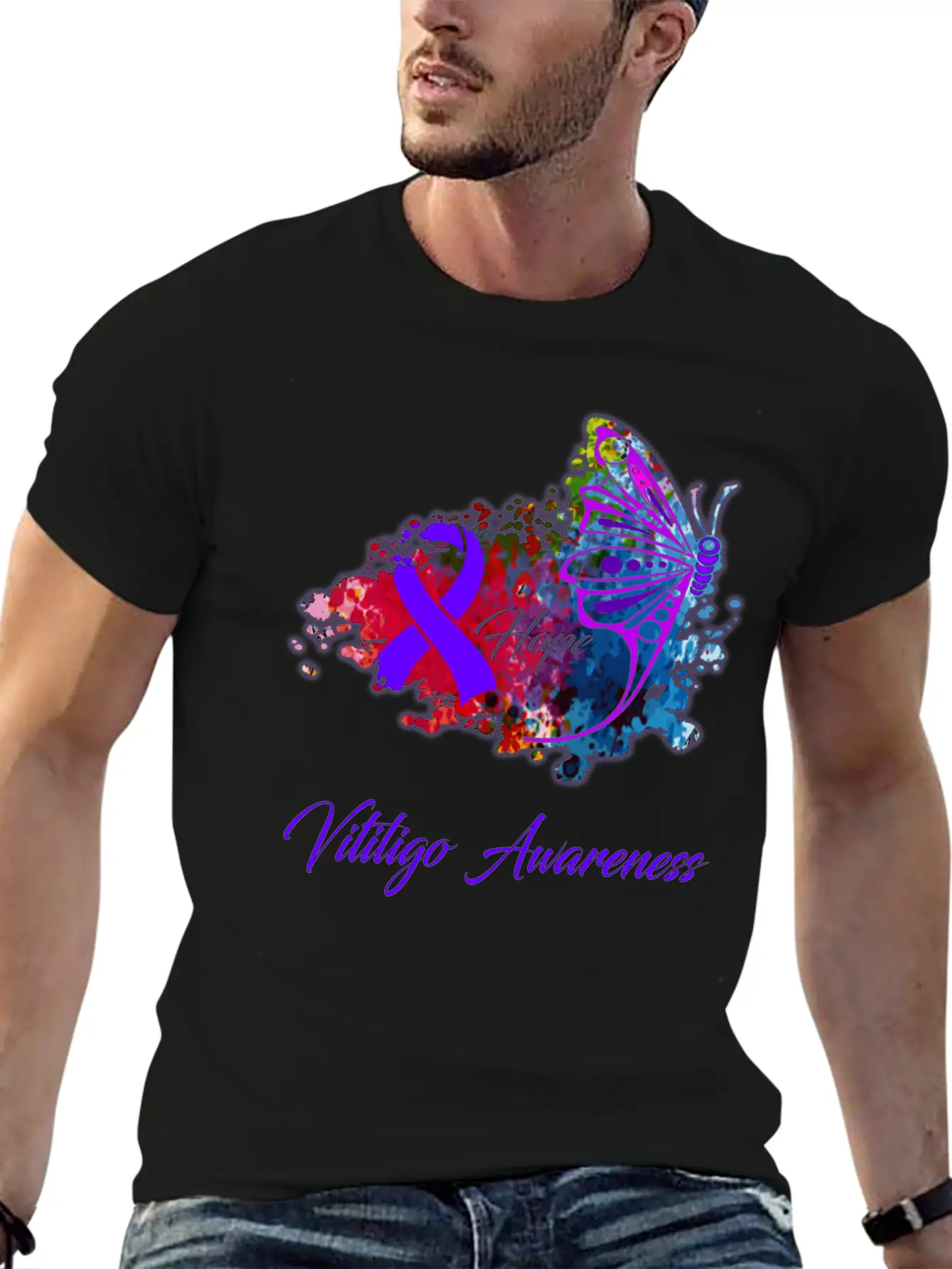 Vitiligo Awareness Comfortable Minimalist Graphic Tee – Summer Style Essential