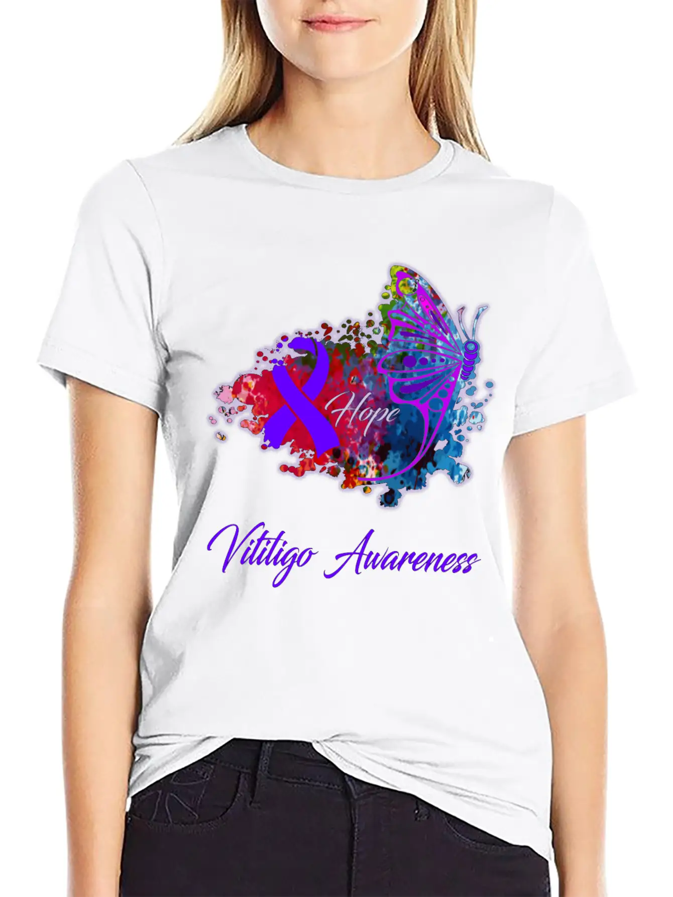 Vitiligo Awareness Comfortable Minimalist Graphic Tee – Summer Style Essential
