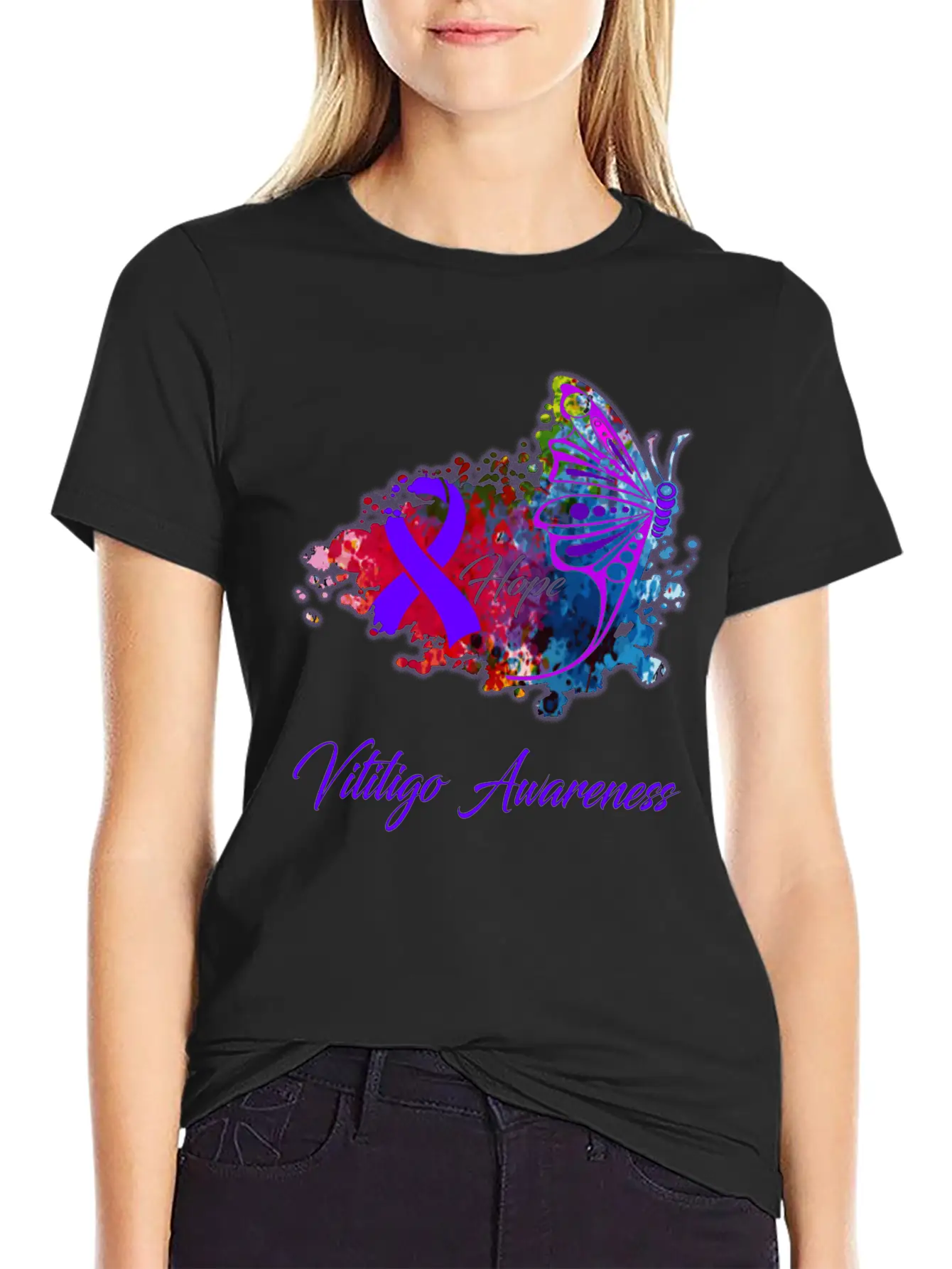 Vitiligo Awareness Comfortable Minimalist Graphic Tee – Summer Style Essential