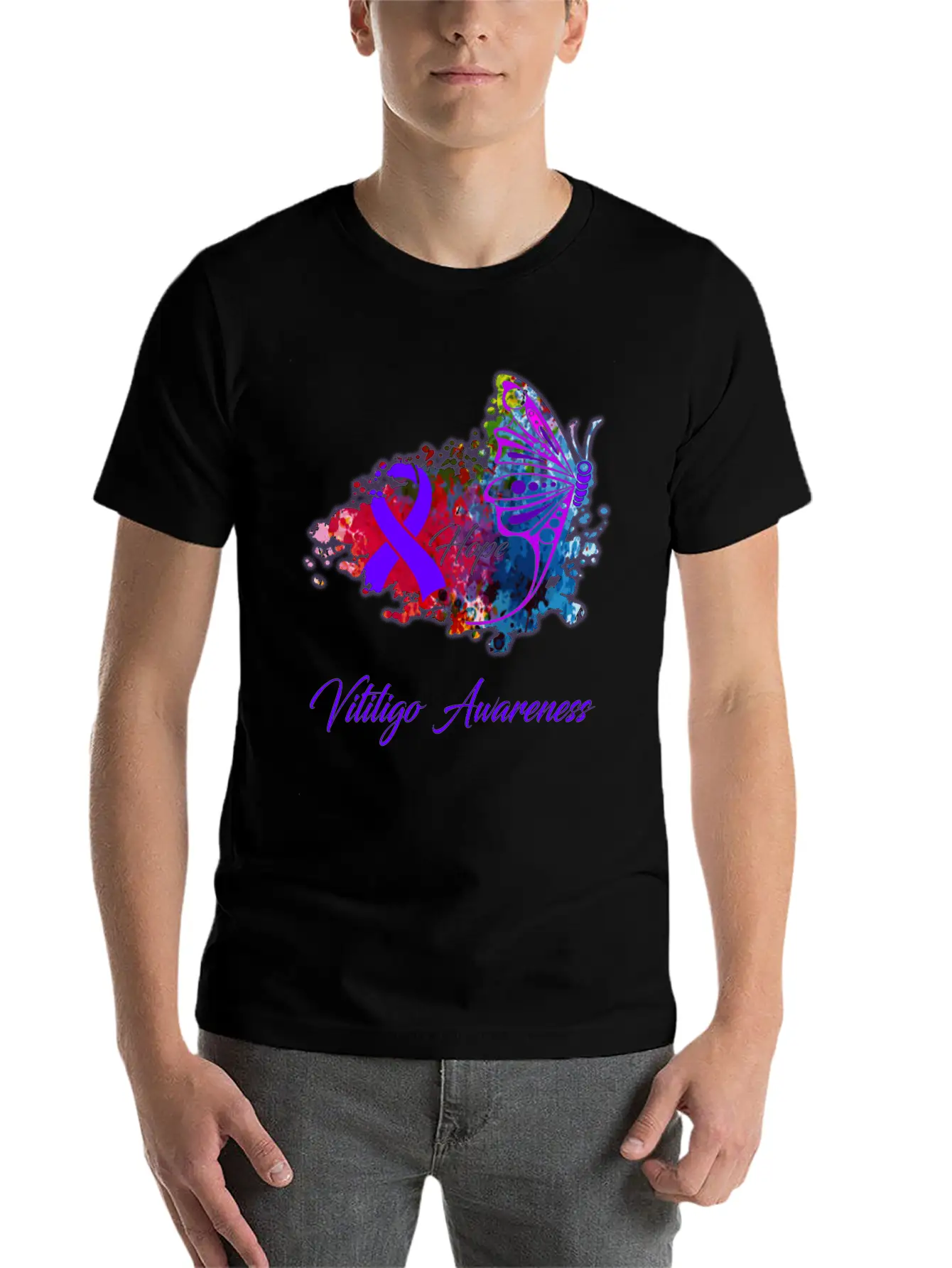 Vitiligo Awareness Comfortable Minimalist Graphic Tee – Summer Style Essential