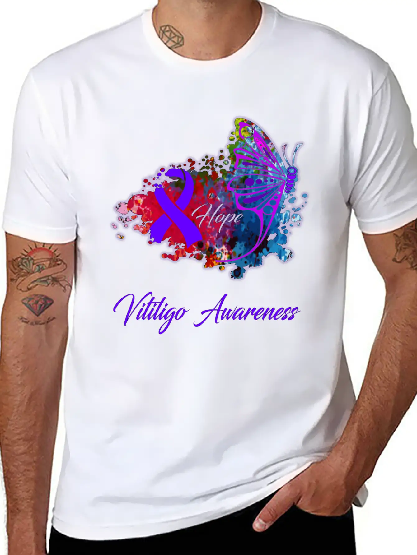 Vitiligo Awareness Comfortable Minimalist Graphic Tee – Summer Style Essential